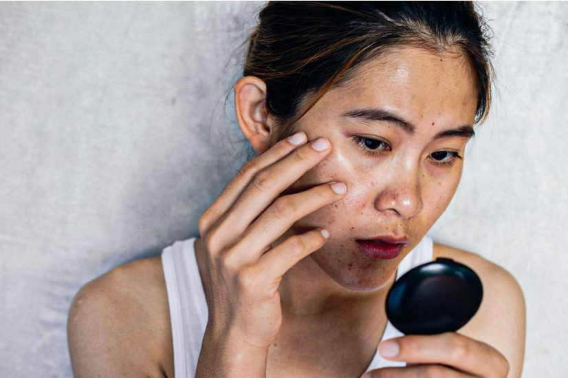 Lí do khiến da bị xỉn màu và cách khắc phục